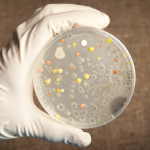 Anthrax: History and Hazards